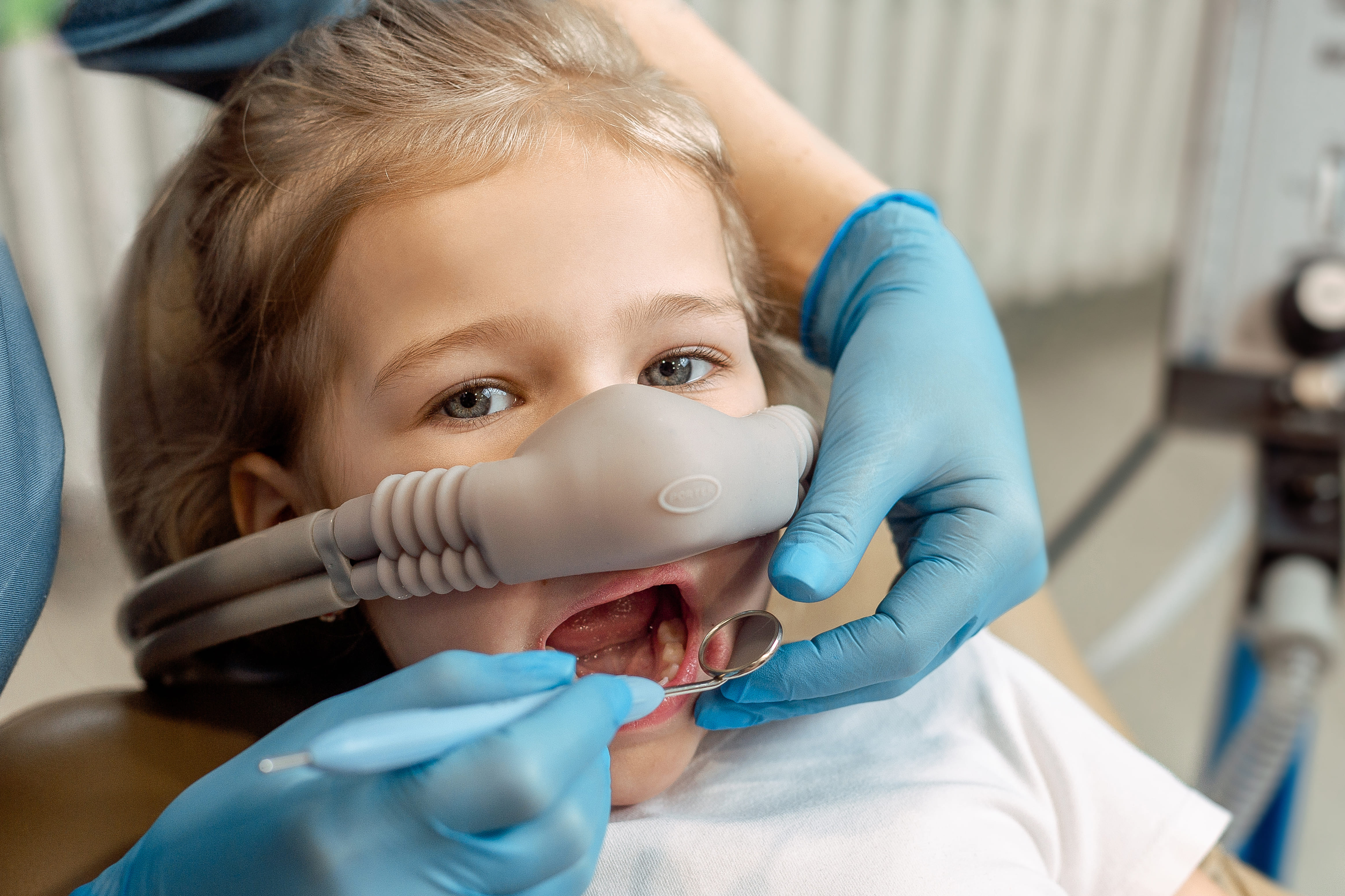 Процедура подрезания уздечки языка ребенку под седацией